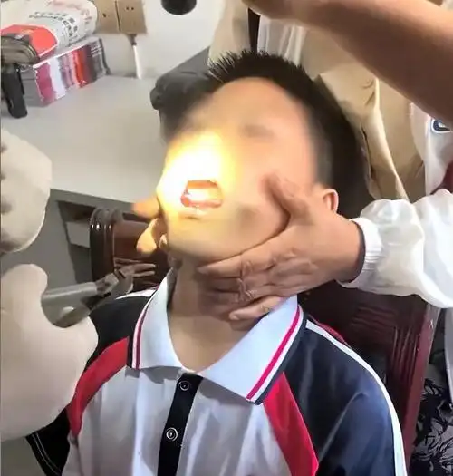 男孩把三角尺塞進(jìn)嘴中被卡